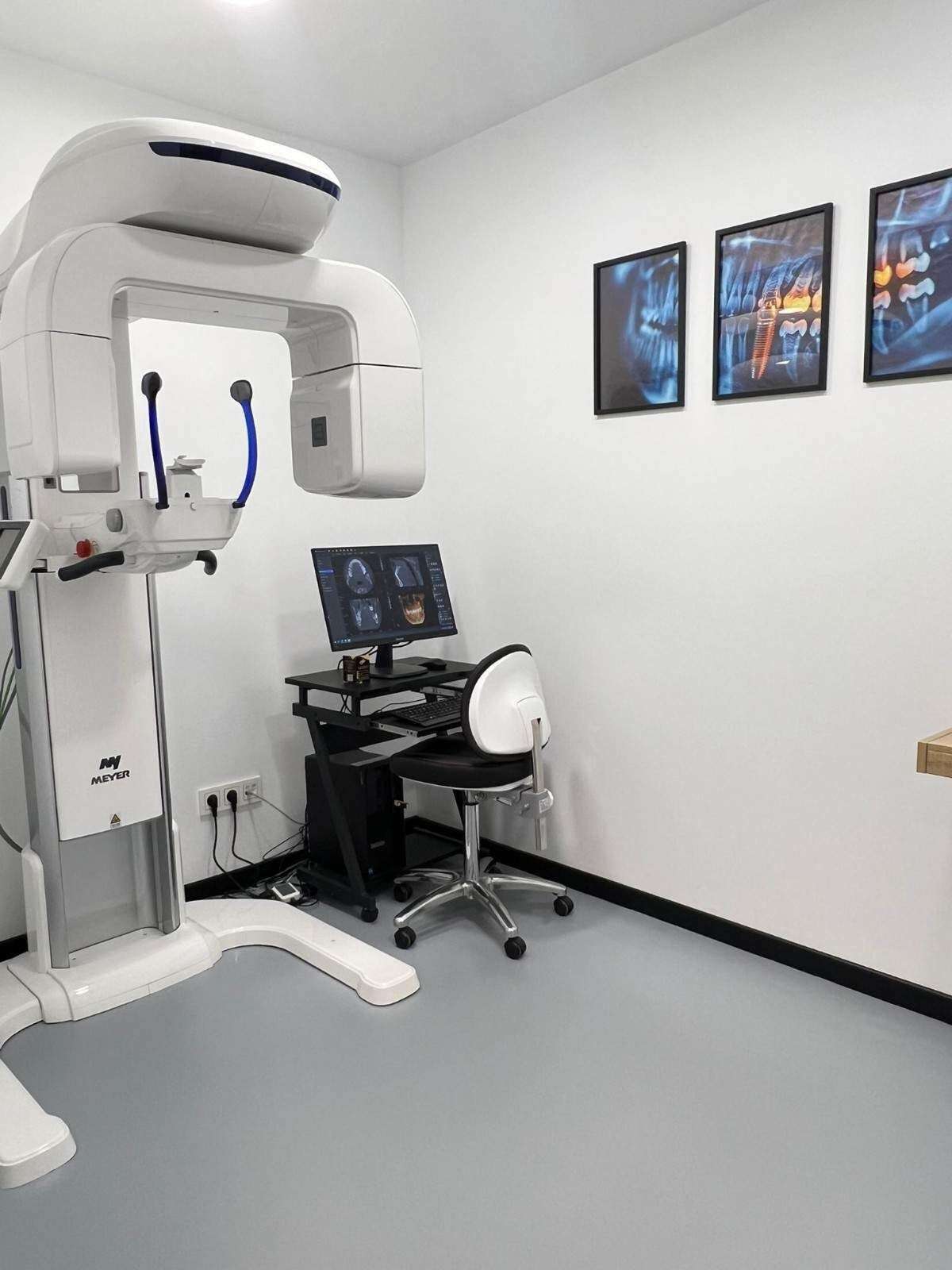 Escáner intraoral y cbct dental en Policlínica Mater Dei, Oviedo